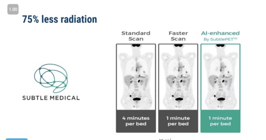PET scan comparison: standard, faster, AI-enhanced