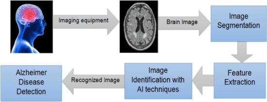 Alzheimer disease detection brain MRI workflow