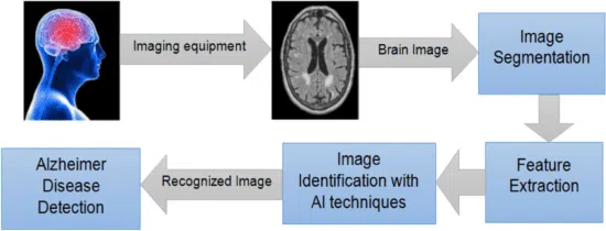 Alzheimer disease detection brain MRI workflow